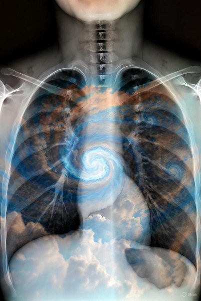 La temporada ciclónica hace más vulnerable a personas con enfermedades pulmonares y afecta su sistema respiratorio